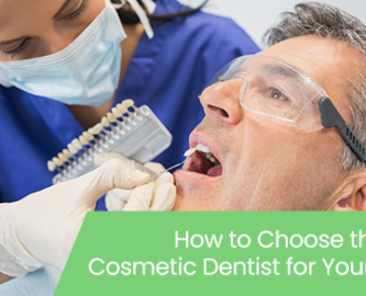 How to choose the right cosmetic dentist for your needs